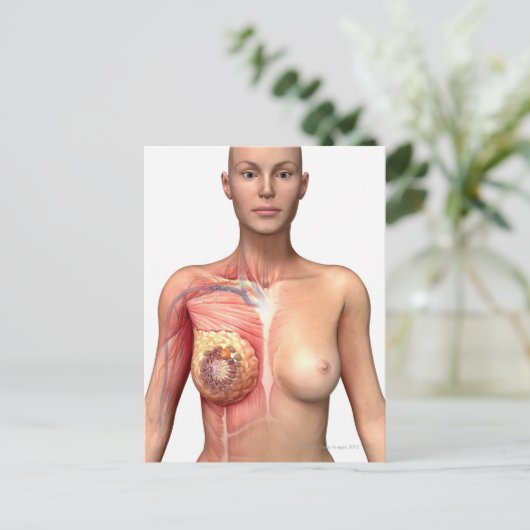乳がん ポストカード (スタンド正面)