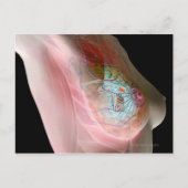 乳がん ポストカード (正面)