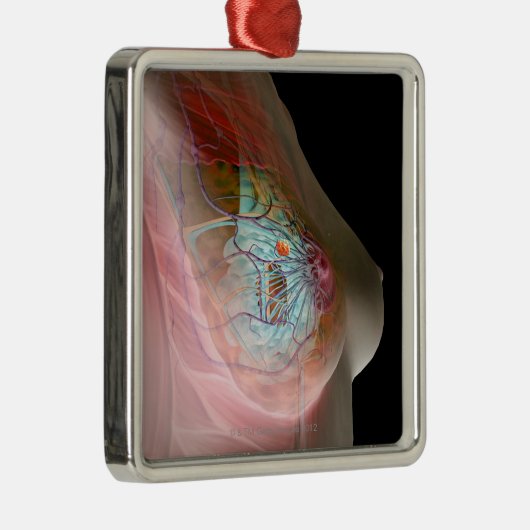 乳癌 メタルオーナメント (右)