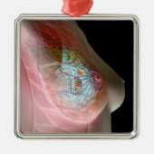 乳癌 メタルオーナメント (正面)