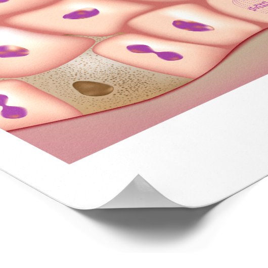 乾燥肌ポスター ポスター (角)