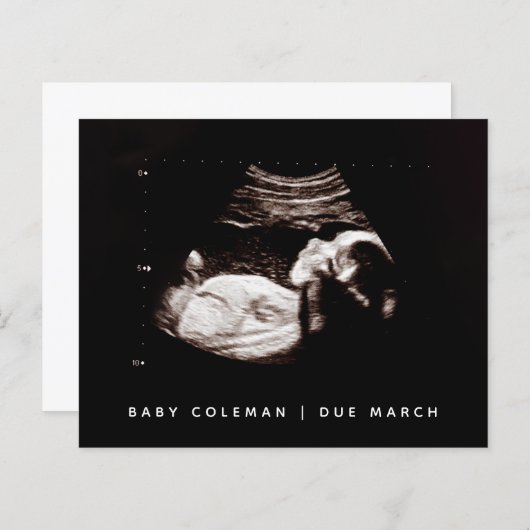 予算妊娠ベビーソノグラム超音波写真 (正面/裏面)