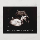 予算妊娠ベビーソノグラム超音波写真 チラシ (正面)