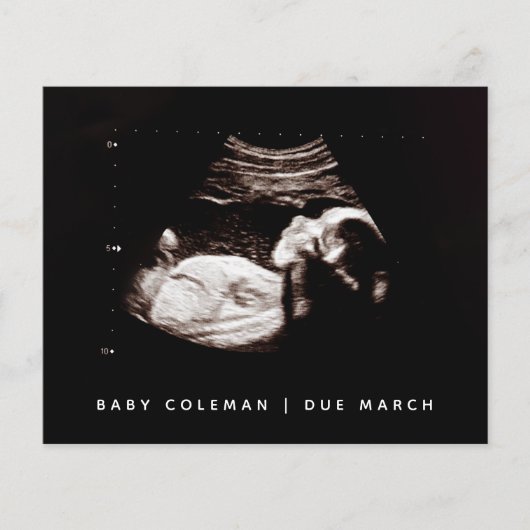 予算妊娠ベビーソノグラム超音波写真 チラシ (正面)