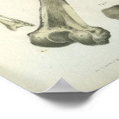 交差する大腿骨解剖学 ポスター (角)