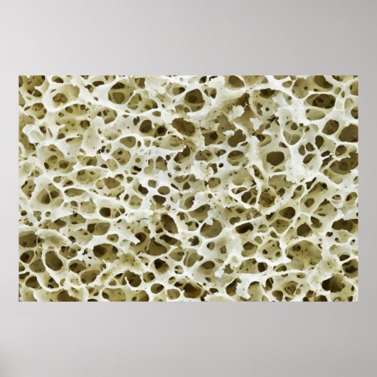 人間のお尻骨から拡大した多孔質のテクスチャ ポスター (正面)