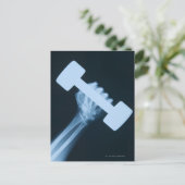 人間の手のX線画像と重さ、クローズアップ ポストカード (スタンド正面)