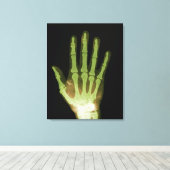 人間の手のX線 キャンバスプリント (インサイチュ (ウッドフロア))