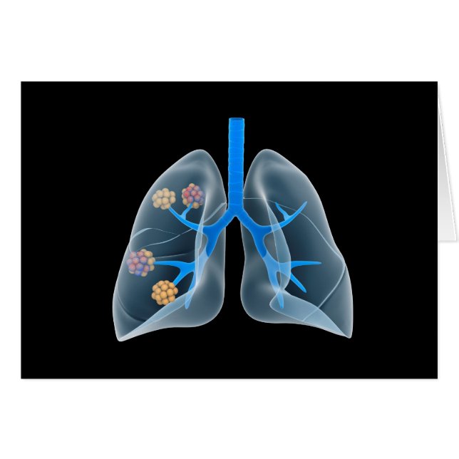 人間の概念像4ハート (正面横)