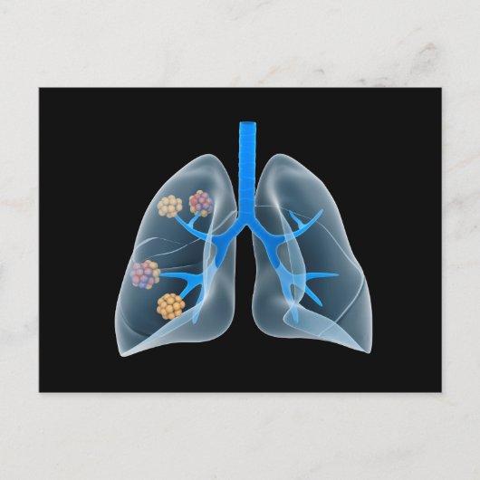 人間の概念像4ハート ポストカード (正面)