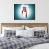 人間の歯の断面 キャンバスプリント (インサイチュ (寝室))