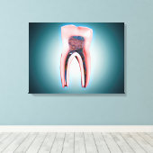 人間の歯の断面 キャンバスプリント (インサイチュ (ウッドフロア))