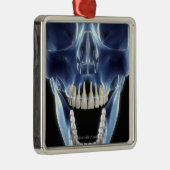 人間の歯のX線のスタイルの一見 メタルオーナメント (右)