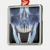 人間の歯のX線のスタイルの一見 メタルオーナメント (左)