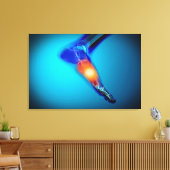 人間の痛みの概念像足 キャンバスプリント (インサイチュ (リビング))