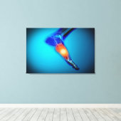 人間の痛みの概念像足 キャンバスプリント (インサイチュ (ウッドフロア))