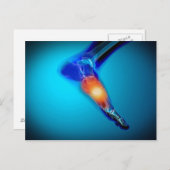 人間の痛みの概念像足 ポストカード (正面/裏面)