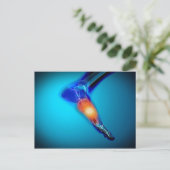 人間の痛みの概念像足 ポストカード (スタンド正面)