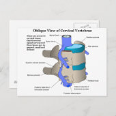 人間の脊柱の頸椎 ポストカード (正面/裏面)