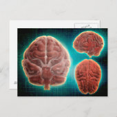 人間の脳の概念的なイメージ(様々な角度から) ポストカード (正面/裏面)