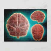 人間の脳の概念的なイメージ(様々な角度から) ポストカード (正面)