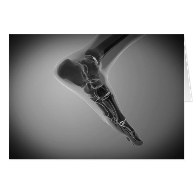 人間のX線ビュー4足 (正面横)