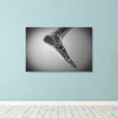 人間のX線ビュー4足 キャンバスプリント (インサイチュ (ウッドフロア))