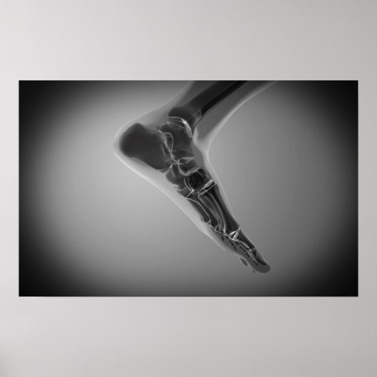 人間のX線ビュー4足 ポスター (正面)