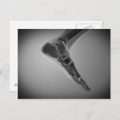 人間のX線ビュー4足 ポストカード (正面/裏面)