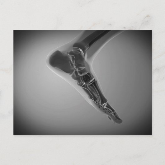 人間のX線ビュー4足 ポストカード (正面)