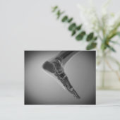 人間のX線ビュー4足 ポストカード (スタンド正面)