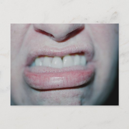 今日は笑顔なし ポストカード (正面)