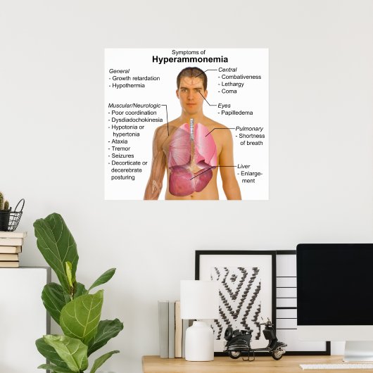 代謝性疾患高アンモニア血症の症状表 ポスター (ホームオフィス)