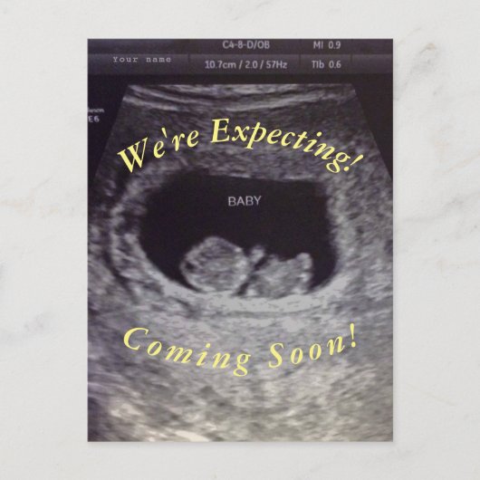 偽物、いたずら妊娠  ポストカード (正面)