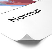 共通角膜条件ポスター ポスター (角)