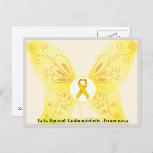 内拡散 ポストカード (正面/裏面)