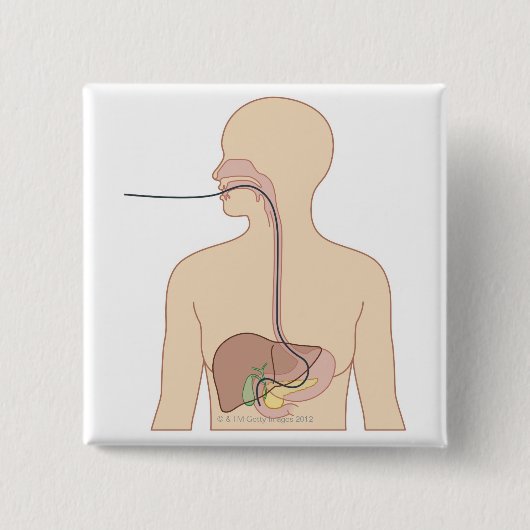 内視鏡ルート 缶バッジ (正面)