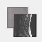 円盤磁石の破断 マグネット (正面/裏面)