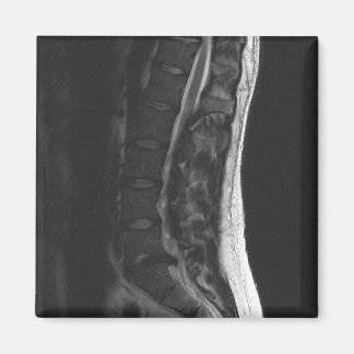 円盤磁石の破断 マグネット