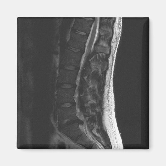 円盤磁石の破断 マグネット (正面)