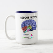 再起動が必要（解剖学的な脳のユーモア） ツートーンマグカップ (左)