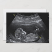 写真シンプル妊娠の告知 案内状 (裏面)