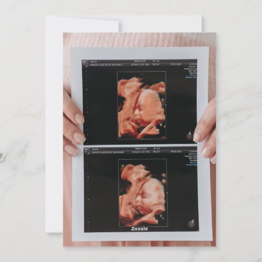 写真超音波クリスマス妊娠の発表 シーズンカード (裏面)