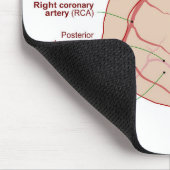 冠動脈循環図ヒトハート マウスパッド (コーナー)