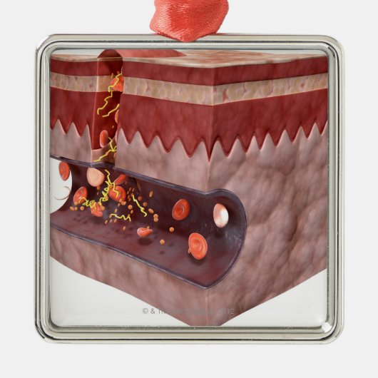 凝血の形成 メタルオーナメント (正面)