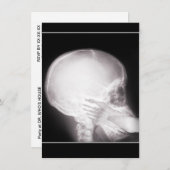 処方招待状経口X線中足 招待状 (正面/裏面)