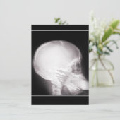 処方招待状経口X線中足 招待状 (スタンド正面)