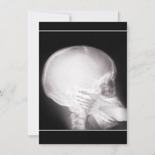 処方招待状経口X線中足 招待状 (正面)