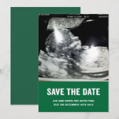 出産予定日をお伝えします妊娠発表 案内状 (正面/裏面)