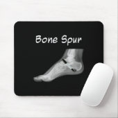 切り株の骨拍動インクペンおもしろいアンチ切り株 マウスパッド (マウス)